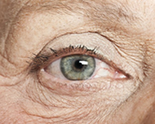 Les remèdes naturels contre les rides pour effacer l’âge de nos yeux.