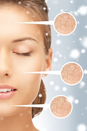 L’hiver est à la base de la sécheresse de la peau plus que l’on croit